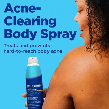 [S&S]: 6-Oz Differin Acne Body Spray