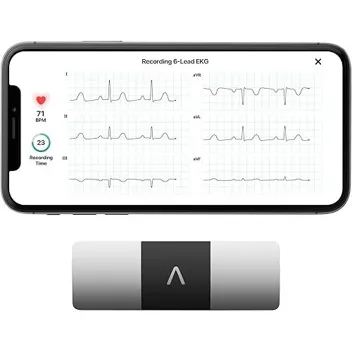 KardiaMobile 6 Six-Lead EKG Monitor (Detects AFib & Irregular Arrhythmias)